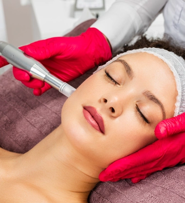 Microneedling